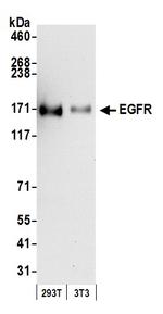 EGFR Antibody in Western Blot (WB)