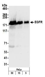 EGFR Antibody in Western Blot (WB)