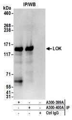 LOK Antibody in Immunoprecipitation (IP)