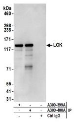 LOK Antibody in Immunoprecipitation (IP)