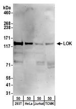 LOK Antibody in Western Blot (WB)