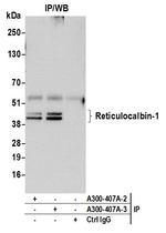 Reticulocalbin-1 Antibody in Immunoprecipitation (IP)