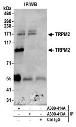 TRPM2 Antibody in Immunoprecipitation (IP)