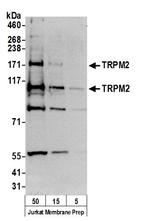 TRPM2 Antibody in Western Blot (WB)