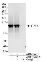 STAT6 Antibody in Immunoprecipitation (IP)