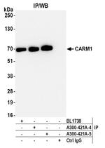 CARM1 Antibody in Immunoprecipitation (IP)