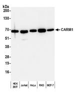 CARM1 Antibody in Western Blot (WB)