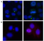 Aurora B Antibody in Immunocytochemistry (ICC/IF)