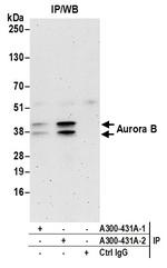 Aurora B Antibody in Immunoprecipitation (IP)