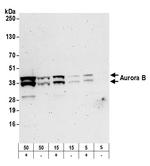 Aurora B Antibody in Western Blot (WB)