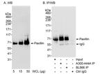 Paxillin Antibody in Western Blot (WB)