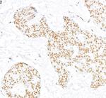 RecQ1 Antibody in Immunohistochemistry (Paraffin) (IHC (P))