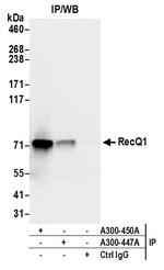 RecQ1 Antibody in Immunoprecipitation (IP)