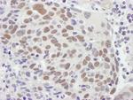 MSH2 Antibody in Immunohistochemistry (Paraffin) (IHC (P))