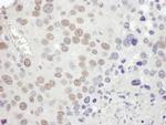 MSH2 Antibody in Immunohistochemistry (Paraffin) (IHC (P))