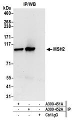 MSH2 Antibody in Immunoprecipitation (IP)