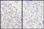 FOXO3a Antibody in Immunohistochemistry (Paraffin) (IHC (P))