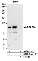 FOXO3a Antibody in Immunoprecipitation (IP)