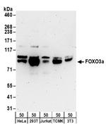 FOXO3a Antibody in Western Blot (WB)