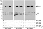 ROCK1 Antibody in Immunoprecipitation (IP)