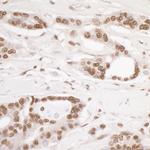 DDB1 Antibody in Immunohistochemistry (Paraffin) (IHC (P))