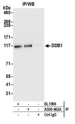 DDB1 Antibody in Immunoprecipitation (IP)