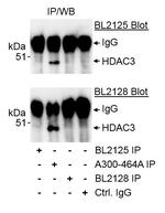 HDAC3 Antibody in Immunoprecipitation (IP)