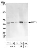 MST1/STK4 Antibody in Western Blot (WB)