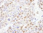 CRM1 Antibody in Immunohistochemistry (Paraffin) (IHC (P))