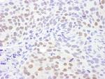 CRM1 Antibody in Immunohistochemistry (Paraffin) (IHC (P))