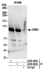 CRM1 Antibody in Immunoprecipitation (IP)