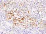 CSE1 Antibody in Immunohistochemistry (Paraffin) (IHC (P))