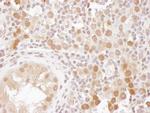 CSE1 Antibody in Immunohistochemistry (Paraffin) (IHC (P))