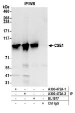 CSE1 Antibody in Immunoprecipitation (IP)