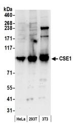 CSE1 Antibody in Western Blot (WB)