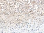 DDX3 Antibody in Immunohistochemistry (Paraffin) (IHC (P))