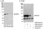 DDX3 Antibody in Western Blot (WB)