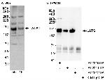 LATS1 Antibody in Western Blot (WB)