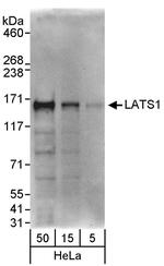 LATS1 Antibody in Western Blot (WB)