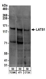 LATS1 Antibody in Western Blot (WB)