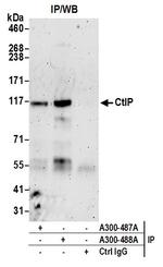 CtIP Antibody in Immunoprecipitation (IP)