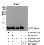 Estrogen Receptor Alpha Antibody in Immunoprecipitation (IP)