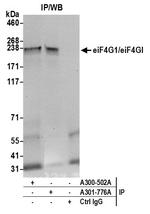 eIF4G1/eIF4GI Antibody in Immunoprecipitation (IP)