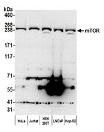 mTOR Antibody in Western Blot (WB)