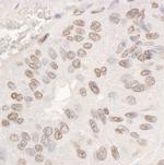 DDX17 Antibody in Immunohistochemistry (Paraffin) (IHC (P))