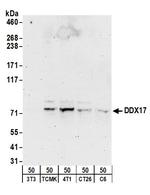 DDX17 Antibody in Western Blot (WB)