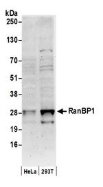 RanBP1 Antibody in Western Blot (WB)