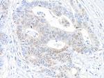 RanBP1 Antibody in Immunohistochemistry (Paraffin) (IHC (P))