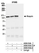 Roquin Antibody in Immunoprecipitation (IP)