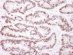 DNA-PKcs Antibody in Immunohistochemistry (Paraffin) (IHC (P))